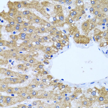 Immunohistochemistry of paraffin-embedded Human liver using CCM2 Polyclonal Antibody at dilution of  1:100 (40x lens).