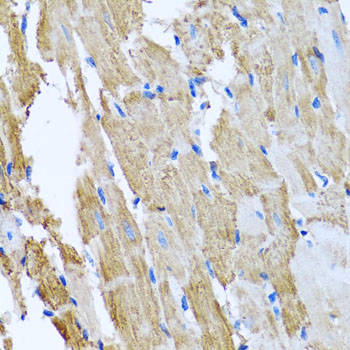 Immunohistochemistry of paraffin-embedded Rat heart using CCM2 Polyclonal Antibody at dilution of  1:100 (40x lens).