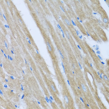 Immunohistochemistry of paraffin-embedded Mouse heart using CCM2 Polyclonal Antibody at dilution of  1:100 (40x lens).
