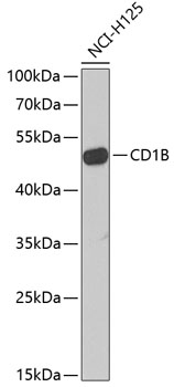 Western blot analysis of extracts of NCI-H125 cells using CD1B Polyclonal Antibody at dilution of 1:1000.