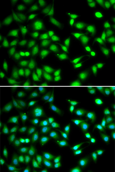 Immunofluorescence analysis of HeLa cells using CDKN2D Polyclonal Antibody