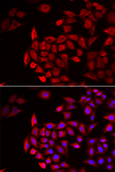 Immunofluorescence analysis of HeLa cells using COCH Polyclonal Antibody