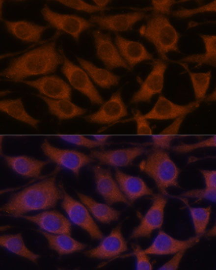 Immunofluorescence analysis of L929 cells using CREB3 Polyclonal Antibody at dilution of  1:100. Blue: DAPI for nuclear staining.