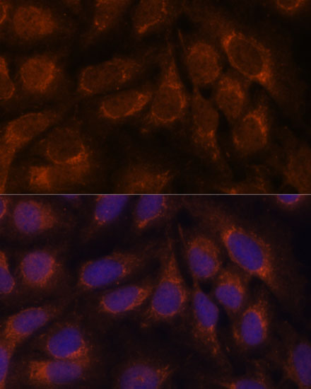 Immunofluorescence analysis of U-2 OS cells using CREB3 Polyclonal Antibody at dilution of  1:100. Blue: DAPI for nuclear staining.