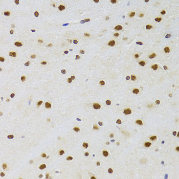 Immunohistochemistry of paraffin-embedded Rat brain using CSRP3 Polyclonal Antibody at dilution of  1:100 (40x lens).