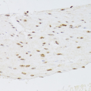 Immunohistochemistry of paraffin-embedded Human stomach using CSRP3 Polyclonal Antibody at dilution of  1:100 (40x lens).