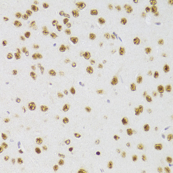 Immunohistochemistry of paraffin-embedded Mouse brain using CSRP3 Polyclonal Antibody at dilution of  1:100 (40x lens).