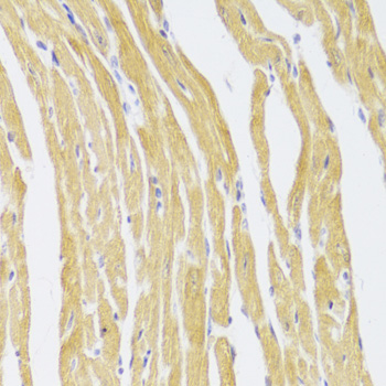 Immunohistochemistry of paraffin-embedded Mouse heart using CSRP3 Polyclonal Antibody at dilution of  1:100 (40x lens).