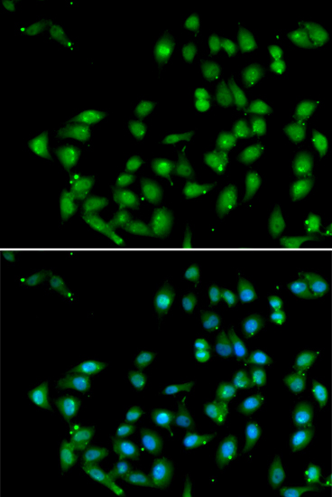 Immunofluorescence analysis of U2OS cells using CTNNBL1 Polyclonal Antibody