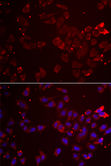 Immunofluorescence analysis of A549 cells using GATM Polyclonal Antibody