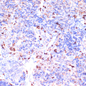 Immunohistochemistry of paraffin-embedded Mouse spleen using GATM Polyclonal Antibody at dilution of  1:100 (40x lens).