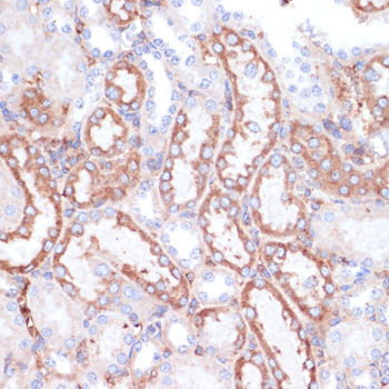 Immunohistochemistry of paraffin-embedded Mouse kidney using GATM Polyclonal Antibody at dilution of  1:100 (40x lens).