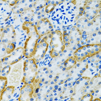 Immunohistochemistry of paraffin-embedded Rat kidney using GDAP1 Polyclonal Antibody at dilution of  1:100 (40x lens).