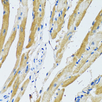 Immunohistochemistry of paraffin-embedded Rat heart using GDAP1 Polyclonal Antibody at dilution of  1:100 (40x lens).