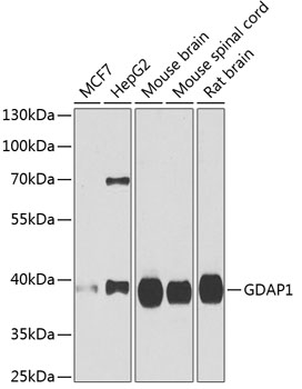 Western blot analysis of extracts of various cell lines using GDAP1 Polyclonal Antibody at dilution of 1:1000.
