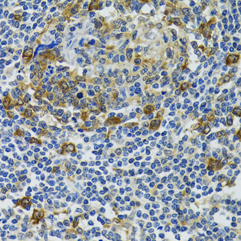 Immunohistochemistry of paraffin-embedded Human tonsil using HSPH1 Polyclonal Antibody at dilution of  1:100 (40x lens).