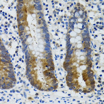 Immunohistochemistry of paraffin-embedded Human vermiform appendix using HSPH1 Polyclonal Antibody at dilution of  1:100 (40x lens).