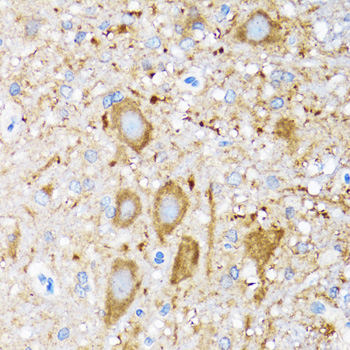 Immunohistochemistry of paraffin-embedded Mouse spinal cord using HSPH1 Polyclonal Antibody at dilution of  1:100 (40x lens).