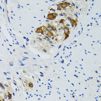 Immunohistochemistry of paraffin-embedded Human colon using HYOU1 Polyclonal Antibody at dilution of  1:100 (40x lens).
