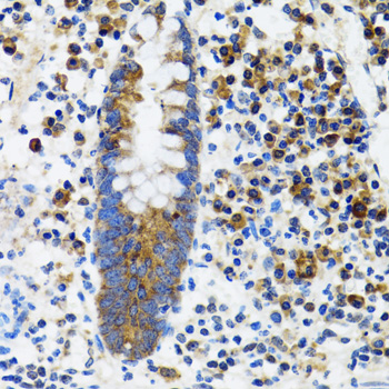 Immunohistochemistry of paraffin-embedded Human vermiform appendix using HYOU1 Polyclonal Antibody at dilution of  1:100 (40x lens).