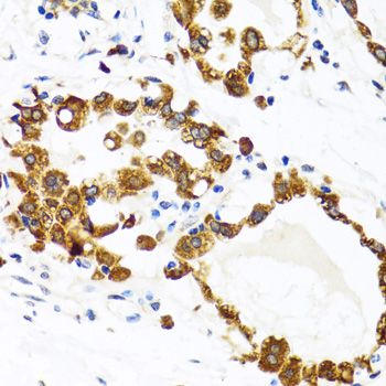 Immunohistochemistry of paraffin-embedded Human breast using HYOU1 Polyclonal Antibody at dilution of  1:100 (40x lens).
