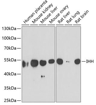 Western blot analysis of extracts of various cell lines using IHH Polyclonal Antibody at dilution of 1:1000.