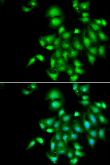 Immunofluorescence analysis of A549 cells using IL20 Polyclonal Antibody