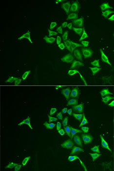 Immunofluorescence analysis of U2OS cells using INPP5J Polyclonal Antibody