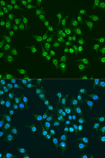 Immunofluorescence analysis of U2OS cells using KLF4 Polyclonal Antibody at dilution of  1:100. Blue: DAPI for nuclear staining.