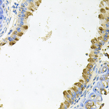 Immunohistochemistry of paraffin-embedded Mouse lung using KLK11 Polyclonal Antibody at dilution of  1:100 (40x lens).