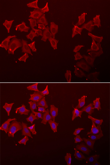 Immunofluorescence analysis of A549 cells using LECT1 Polyclonal Antibody