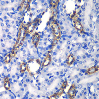 Immunohistochemistry of paraffin-embedded Rat kidney using MATK Polyclonal Antibody at dilution of  1:100 (40x lens).