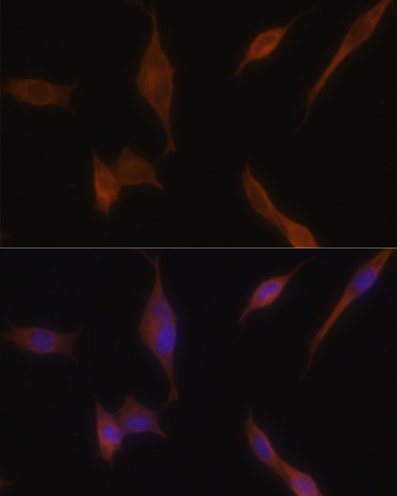 Immunofluorescence analysis of NIH-3T3 cells using MLPH Polyclonal Antibody at dilution of  1:100. Blue: DAPI for nuclear staining.