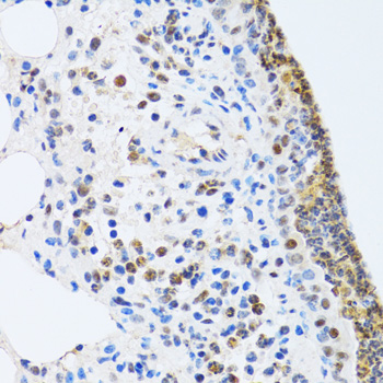 Immunohistochemistry of paraffin-embedded Rat lung using MTA3 Polyclonal Antibody at dilution of  1:100 (40x lens).