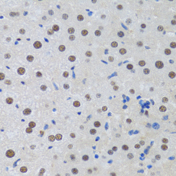 Immunohistochemistry of paraffin-embedded Rat liver using MTA3 Polyclonal Antibody at dilution of  1:100 (40x lens).