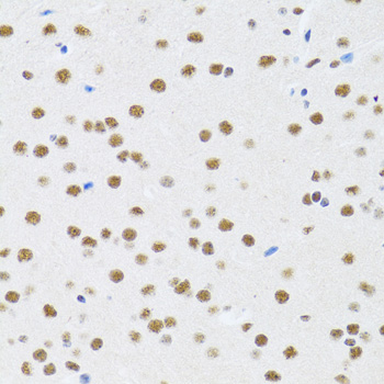 Immunohistochemistry of paraffin-embedded Rat brain using MTA3 Polyclonal Antibody at dilution of  1:100 (40x lens).