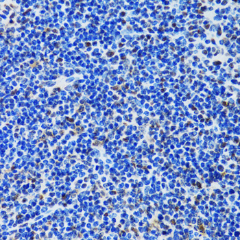 Immunohistochemistry of paraffin-embedded Rat spleen using MTA3 Polyclonal Antibody at dilution of  1:100 (40x lens).