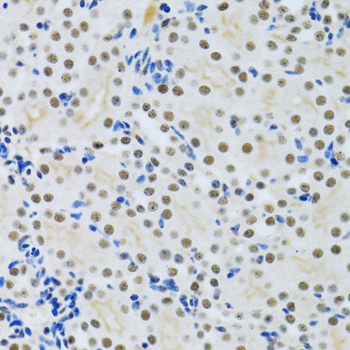 Immunohistochemistry of paraffin-embedded Rat kidney using MTA3 Polyclonal Antibody at dilution of  1:100 (40x lens).