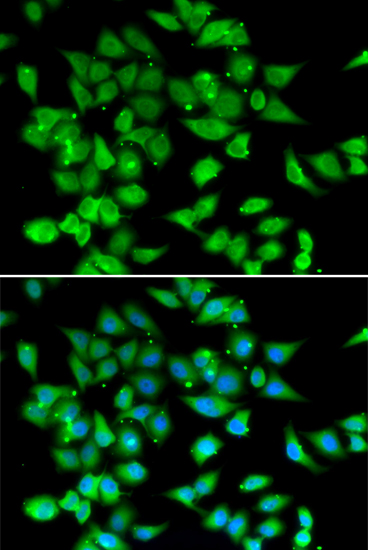 Immunofluorescence analysis of HeLa cells using NFATC3 Polyclonal Antibody