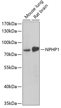 Western blot analysis of extracts of various cell lines using NPHP1 Polyclonal Antibody at dilution of 1:1000.