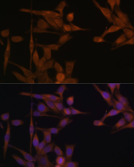 Immunofluorescence analysis of HeLa cells using PPP2CA Polyclonal Antibody at dilution of  1:100. Blue: DAPI for nuclear staining.