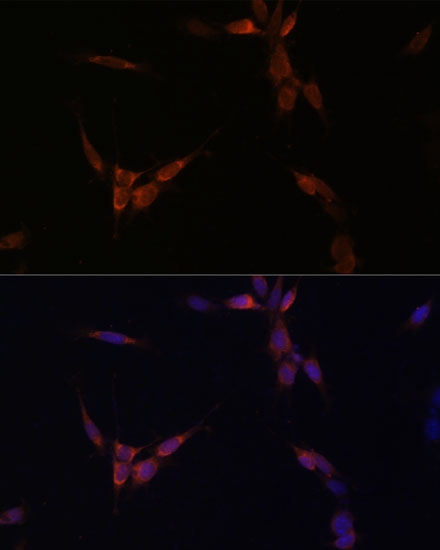 Immunofluorescence analysis of NIH/3T3 cells using PPP2CA Polyclonal Antibody at dilution of  1:100. Blue: DAPI for nuclear staining.
