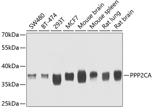 Western blot analysis of extracts of various cell lines using PPP2CA Polyclonal Antibody at dilution of 1:1000.