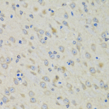 Immunohistochemistry of paraffin-embedded Mouse brain using RAE1 Polyclonal Antibody at dilution of  1:100 (40x lens).