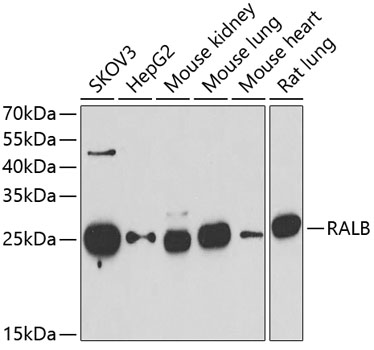 Western blot analysis of extracts of various cell lines using RALB Polyclonal Antibody at dilution of 1:1000.