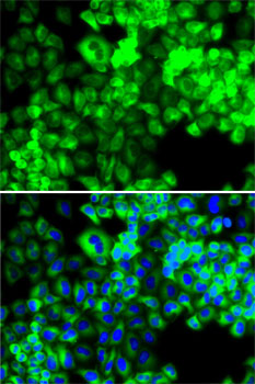 Immunofluorescence analysis of MCF7 cells using SARS Polyclonal Antibody