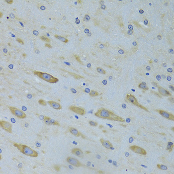 Immunohistochemistry of paraffin-embedded Rat brain using SARS Polyclonal Antibody at dilution of  1:100 (40x lens).