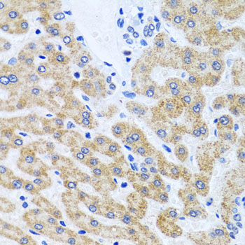 Immunohistochemistry of paraffin-embedded Human liver using SCO1 Polyclonal Antibody at dilution of  1:100 (40x lens).