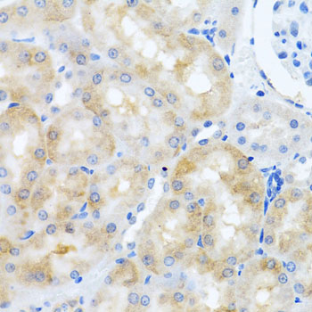 Immunohistochemistry of paraffin-embedded Rat kidney using SCO1 Polyclonal Antibody at dilution of  1:100 (40x lens).