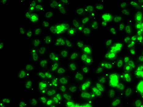 Immunofluorescence analysis of HeLa cells using SECISBP2 Polyclonal Antibody